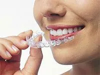 Invisalign Clear Braces